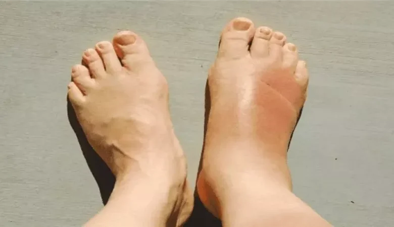 القدم السكري